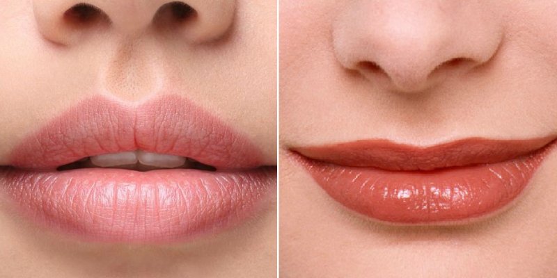 different lip shapes