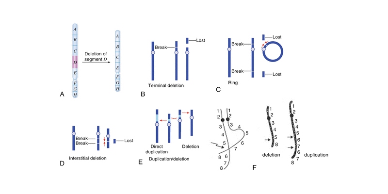 Change In The Structure Of The Chromosome Trivia Quiz
